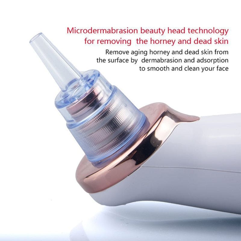 Bubble Black Head Remover, Vacuum Pore Cleaner, Acne Cleanser, Black Spots Removal, Face Nose Deep Cleaning Tools, Pimple Pore Cleansing Device, Beauty Skin Care Tool, 5 Sensors USB Rechargeable Blackhead Vacuum Cleaner Kit for Women and Men Bubble Black Head Remover, Vacuum Pore Cleaner, Acne Cleanser, Black Spots Removal, Face Nose Deep Cleaning Tools, Pimple Pore Cleansing Device, Beauty Skin Care Tool, 5 Sensors USB Rechargeable Blackhead Vacuum Cleaner Kit for Women and Men